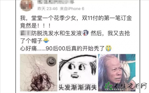 90后们竟已经秃了 年轻人脱发是什么原因